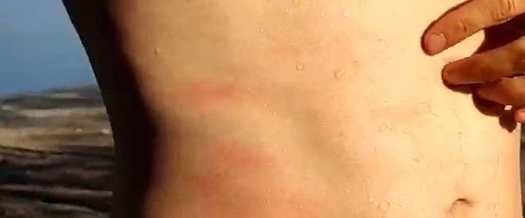 Yüzlercesi sahile vurdu, dokunan anında zehirleniyor! Mavi renklilere sakın yaklaşmayın, ölüm tehlikesi var 9